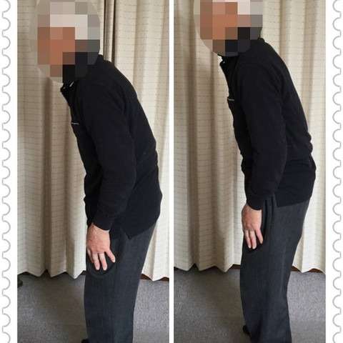 85歳 男性の症例写真